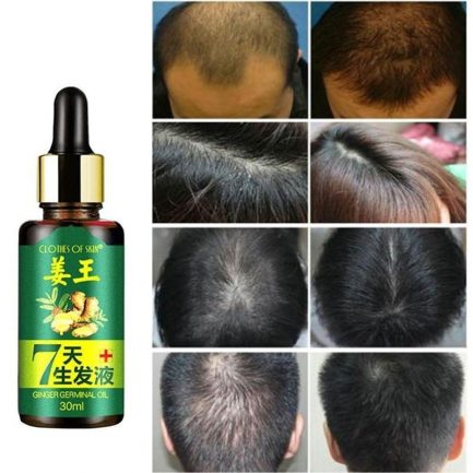 7 day ginger germinal serum, essence loss treatement growth hair, 30ml